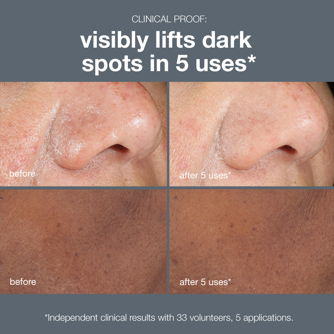NEW! PowerBright Dark Spot Peel - AVAILABLE FROM MARCH 7
