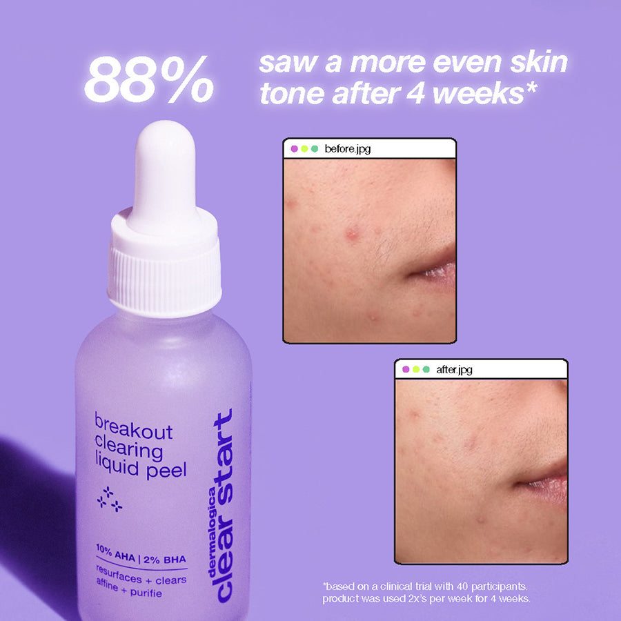 NUOVO! Breakout Clearing Liquid Peel